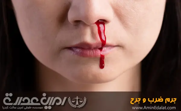 جرم ضرب و جرح