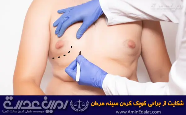 شکایت از جراحی سینه مردان (ژنیکوماستی)