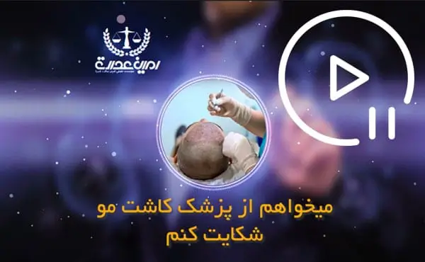 شکایت کاشت مو