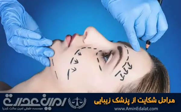 مراحل شکایت از پزشک زیبایی